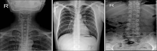15 X-Series Portable Digital X Ray Delivers Motorized DR System For All X-ray Imaging Deed