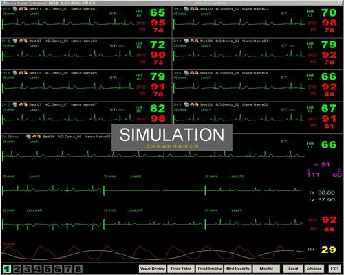 sistema de vigilância central de monitor paciente da cabeceira portátil